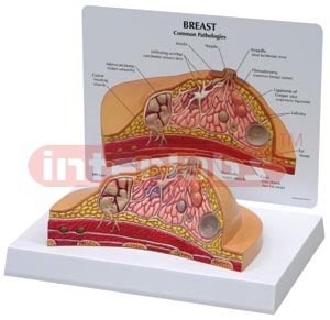 Breast Cross Section